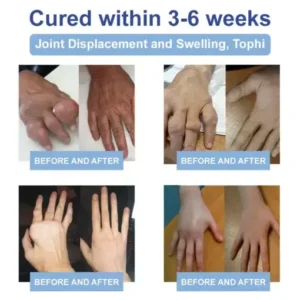 KUBOZN® Advanced Magnesium Pain Relief Cream