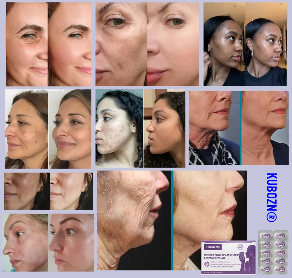 KUBOZN® Exosome Cellular Age-Reverse & Firming Capsules