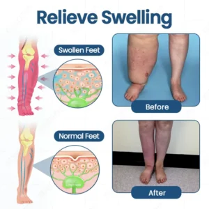 KUBOZN® Roll-On Cream for Lymphatic Drainage & Swelling Relief