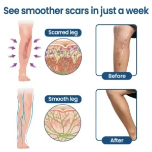 KUBOZN® Triple-Roller Microcurrent ScarRepair Gel