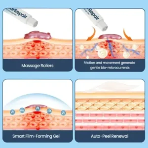 KUBOZN® Triple-Roller Microcurrent ScarRepair Gel