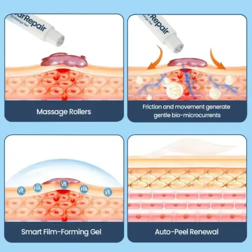 KUBOZN® Triple-Roller Microcurrent ScarRepair Gel